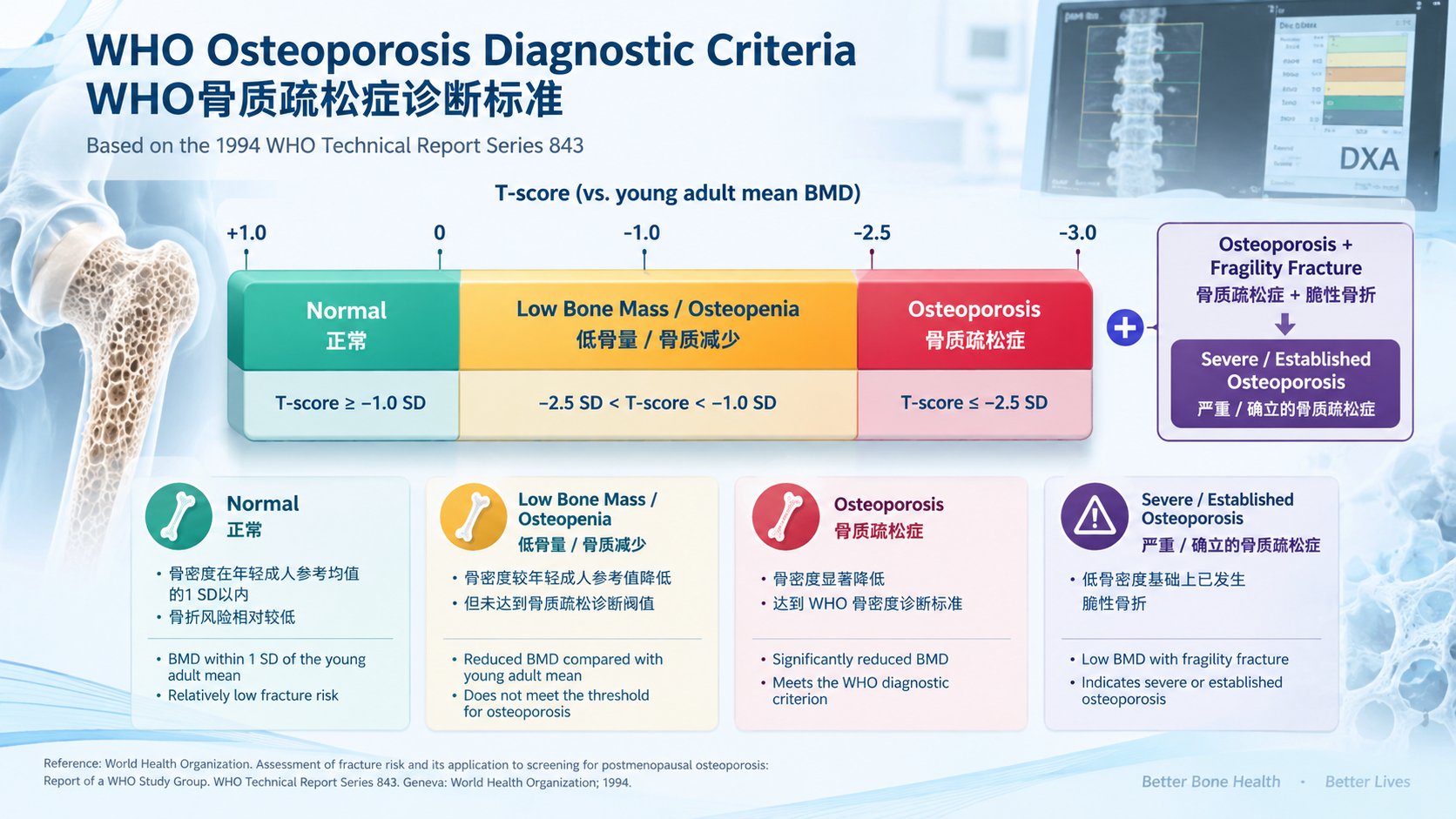 WHO Osteoporosis Diagnostic Criteria